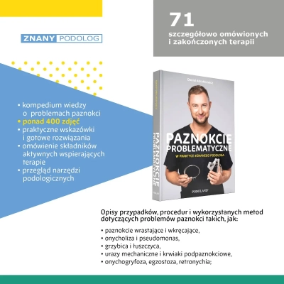 daniel-abratkiewicz-ksiazka-paznokcie-problematyczne.webp